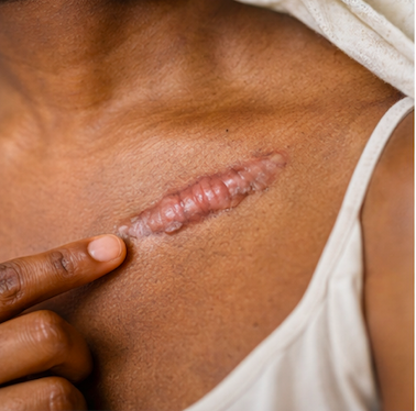 Approche globale et bienveillance